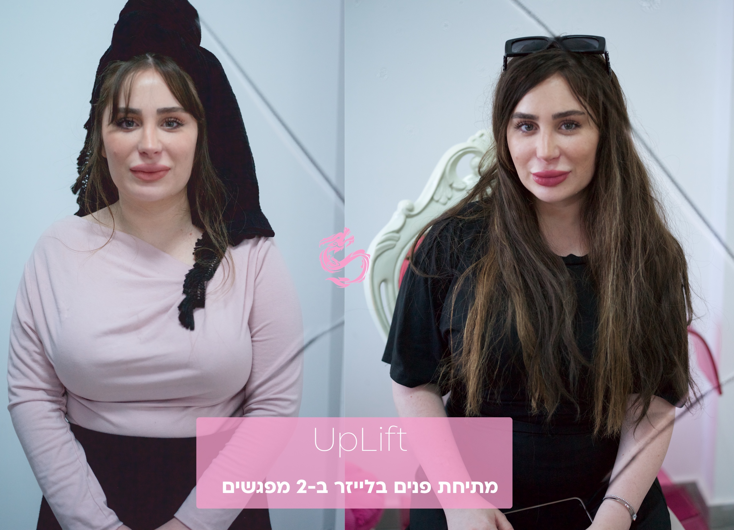 UpLift - מתיחת פנים בלייזר שמבטלת צורך בניתוח 1 מתיחת פנים בלייזר UpLift