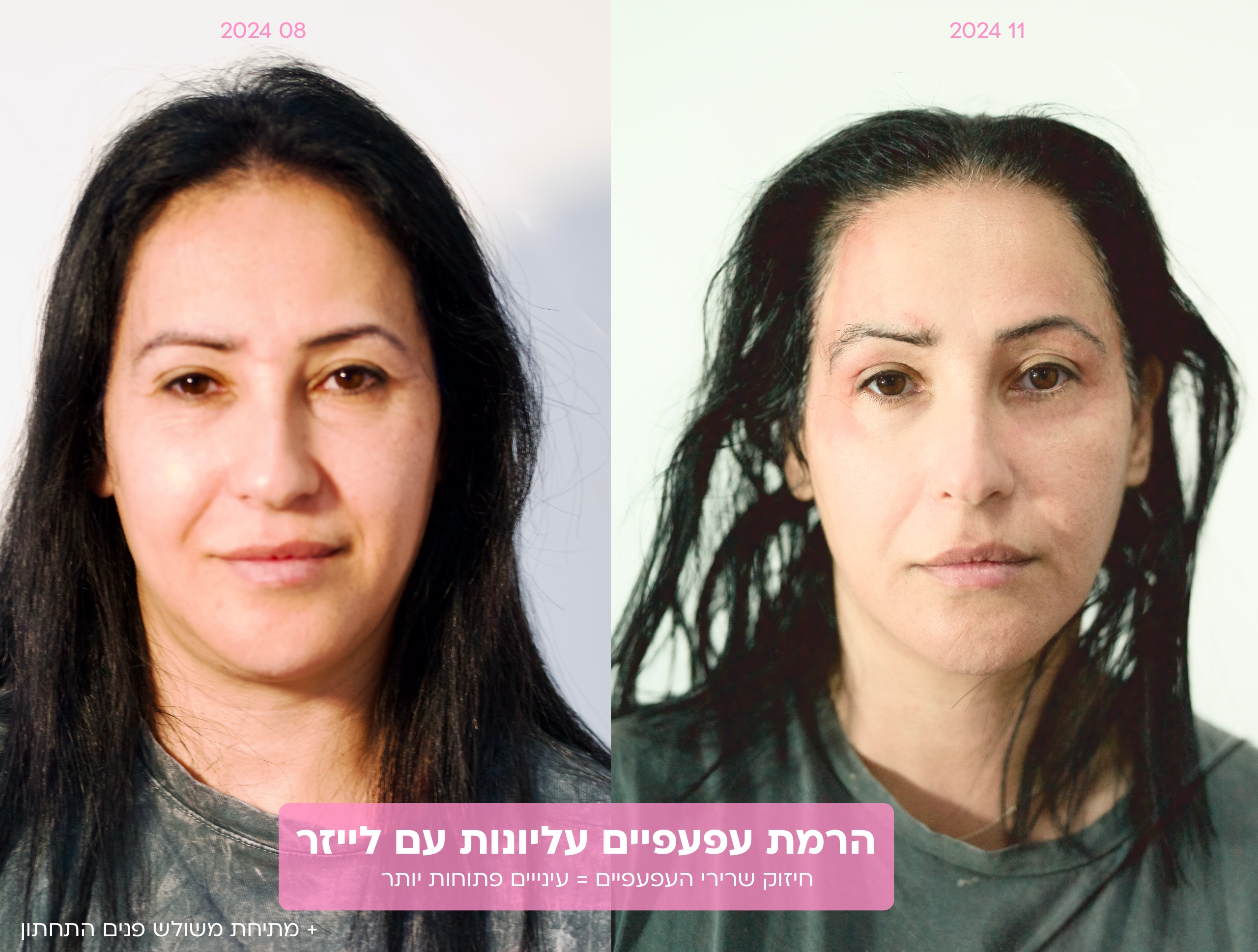 SmoothEye in Israel