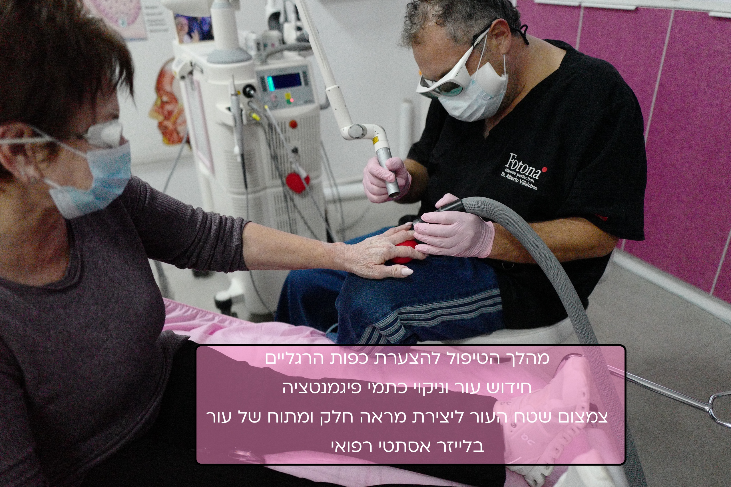 הצערת מראה כפות הידיים בלייזר 4 מהלך הטיפול להצערת כפות ידיים