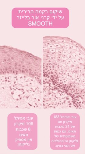טיפול נחירות שפותר בעיה | ע״י אף אוזן וגרון | בלייזר רפואי 8 IMG 0516
