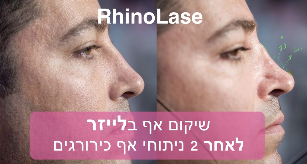 אודות 1 IMG 0330