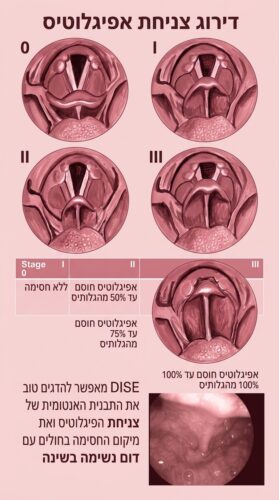 טיפול נחירות שפותר בעיה | ע״י אף אוזן וגרון | בלייזר רפואי 12 IMG 0619
