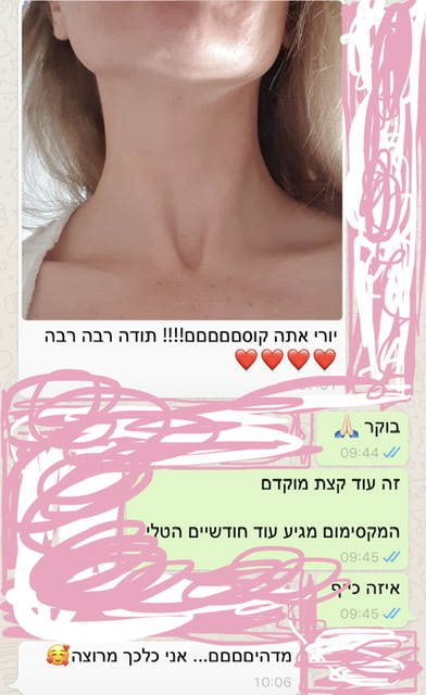 Подтяжка шеи 14 EEF6B1CB AB83 4FD9 A782 CFEBFE6931DD