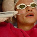 5D - пластическая лазерная медицина лица 17 טיפול תת עורי בצלקות אקנה