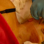 משוואה מנצחת לפנים צעירות 5D Light 26 מהלך טיפול קילוף עור בלייזר נרקיסיה