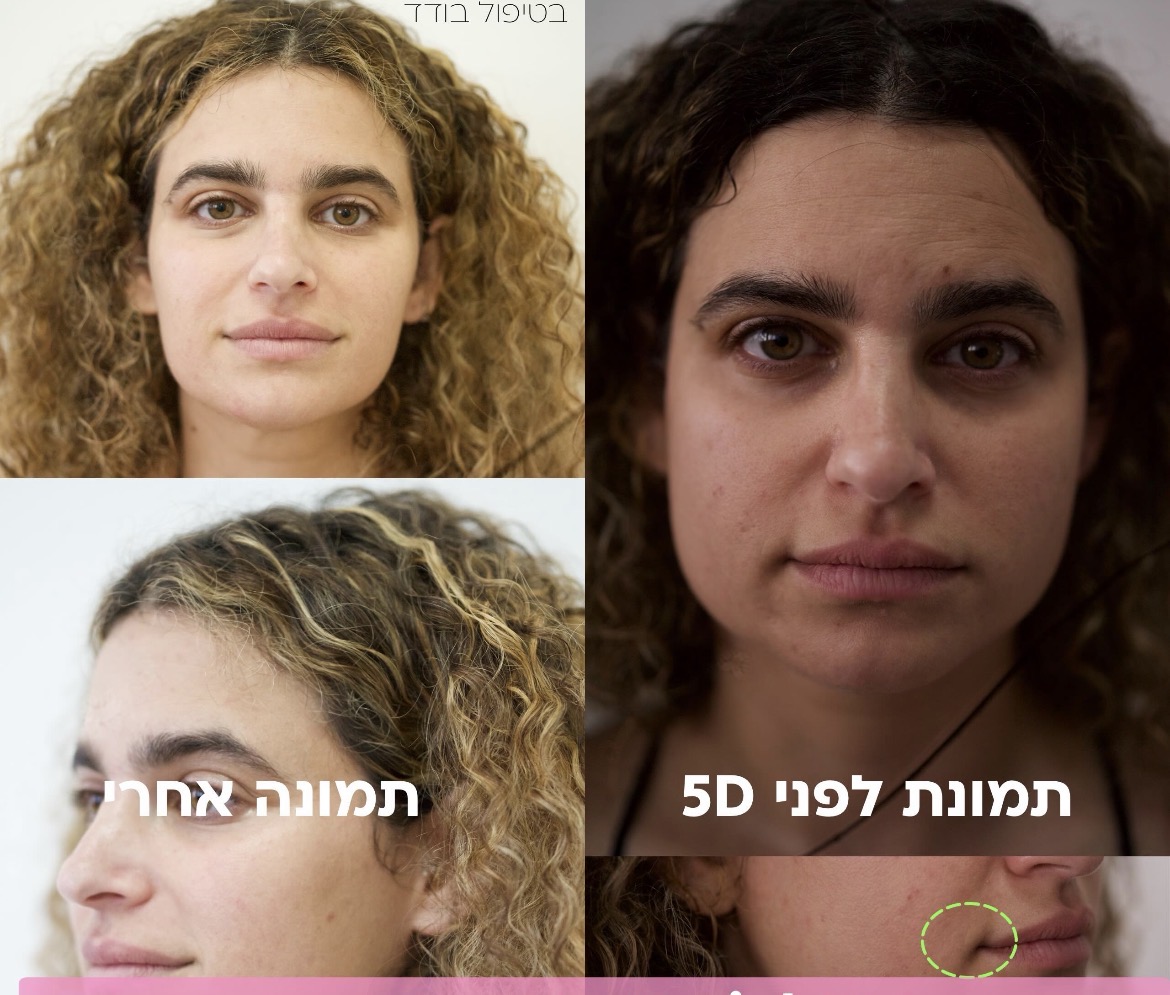 משוואה מנצחת לפנים צעירות 5D Light 4 IMG 7626
